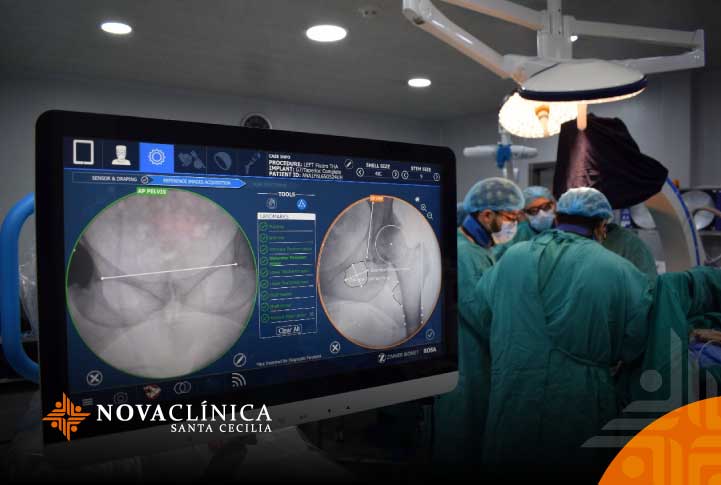 Revolucionando la Cirugía Articular en Ecuador: Tecnología Robótica en Novaclínica Santa Cecilia